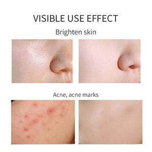 Espuma Limpiadora Facial Orgánica de Fábrica con Vitamina C, Antiarrugas e Hidratante, para el Cuidado del Acné Corporal - Product Image 6