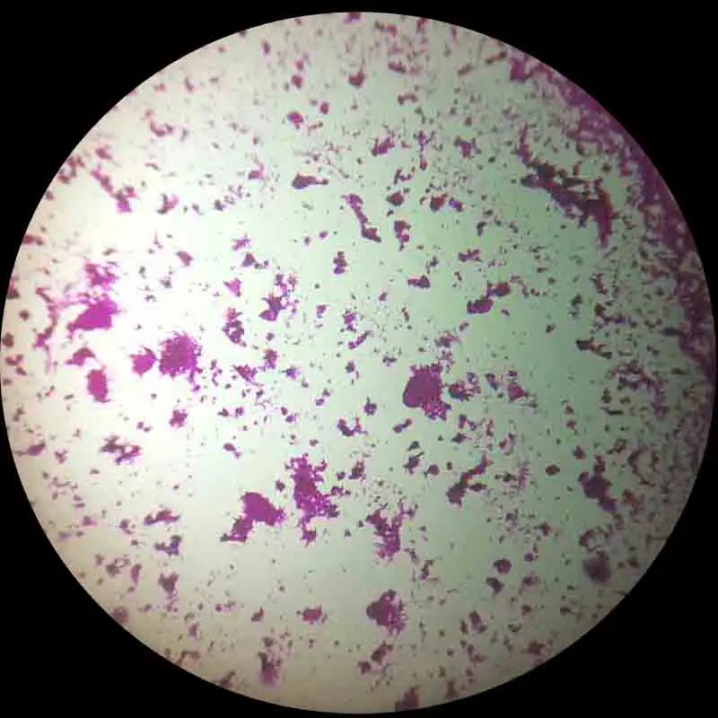 100Pcs Microscope Microbiologie Préparés Diapositives