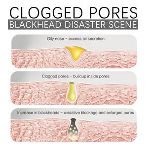 Vente en gros de points noirs propres et de comédons un type de masque facial à peindre Masque facial pour l'élimination des points noirs - Product Image 4