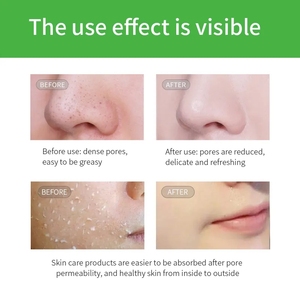 Marque privée Vente en gros Crème exfoliante naturelle à la vitamine B12 et blanchissante pour le corps et le visage - Product Image 4