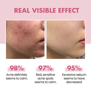 Marque privée Niacinamide B3 Hydratant pour le visage Produits de blanchiment de la peau Crème et lotion éclaircissantes pour le visage - Product Image 5