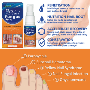 Soins des pieds, herbes naturelles chinoises, 30 ml, meilleur traitement pour les infections fongiques des ongles des pieds et réparation des ongles fongiques - Product Image 5