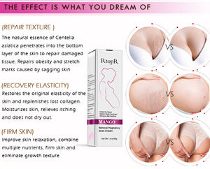 Ango-coche tretch, Ream o regnancy epair - Product Image 5