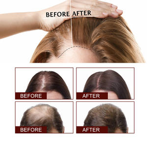 OUHOEクリーニング頭皮保湿厚毛滑らかでふわふわアンチ脱毛シャンプー - Product Image 4