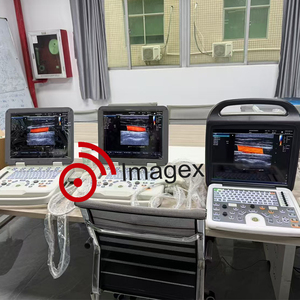 Máquina de Ecografía Obstétrica de ultrasonido <span class=keywords><strong>Doppler</strong></span> veterinario con ultrasonido <span class=keywords><strong>Doppler</strong></span> para imágenes fetales - Product Image 2