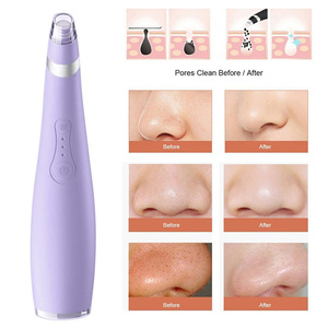 IFINE BEAUTY-<span class=keywords><strong>mini</strong></span> máquina eliminadora de espinillas, limpiador de poros eléctrico al vacío, recargable por usb - Product Image 3