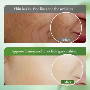 <span class=keywords><strong>BIOAQUA</strong></span> Orgánica Natural Sequedad Hidratante Antienvejecimiento Blanqueamiento Iluminar <span class=keywords><strong>Crema</strong></span> Facial de <span class=keywords><strong>Aloe</strong></span> <span class=keywords><strong>Vera</strong></span> - Product Image 6
