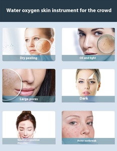 Máquina de Hidrodermoabrasión con Oxígeno al Mejor Precio, Rejuvenecimiento Óptico de la Piel, para Belleza Profesional - Product Image 6