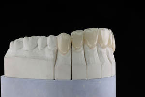 Dentisterie Esthétique Chine Dentaire <span class=keywords><strong>Prix</strong></span> Usine Dents Artificielles Personnalisé Pfm Dentaire Métal <span class=keywords><strong>Céramique</strong></span> <span class=keywords><strong>Couronne</strong></span> - Product Image 4