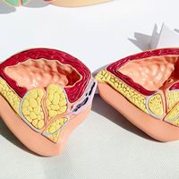 Modèle d'anatomie pelvienne masculine Yulin : Structure normale et structure de la prostate pour l'enseignement en urologie, démonstration de l'hyperplasie bénigne de la prostate