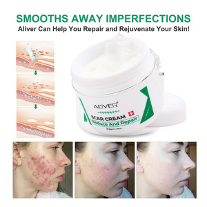 Crème pour le visage Aliver, crème pour éliminer les cicatrices, pour améliorer les cicatrices de brûlures, réduire la pigmentation, améliorer les cicatrices d'acné - Product Image 5