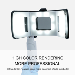 Kit de Fotografía Dental Bluetooth de Fábrica, Luz Doble para Teléfono Móvil, Fotografía Dental, Tatuajes, Joyería, Macrofotografía - Product Image 4