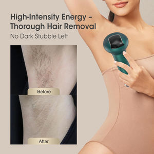 Appareil d'épilation au laser IPL saphir, appareil d'épilation au laser IPL, appareil d'épilation au laser pour usage domestique, salon, équipement de beauté indolore - Product Image 6