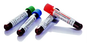 Mingray R & D BC-3D BC-5D asli 3-bagian <span class=keywords><strong>Hematology</strong></span> Controls 3ml untuk 3 bagian <span class=keywords><strong>5</strong></span> bagian <span class=keywords><strong>Hematology</strong></span> kontrol mesin kit 3D - Product Image 2