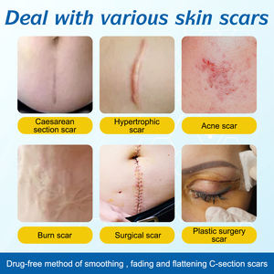 ALIVER 1.8X120 ''rouleau peau réparatrice brûlure chirurgicale cicatrice patchs Silicone cicatrice Gel feuilles d'enlèvement - Product Image 4