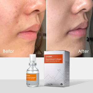 D-nutrimec Skin Repair Essence Beschädigte Barriere und beruhigende Hautpflege Rekombinantes Kollagen Multi Recovery Serum für Serum - Product Image 1
