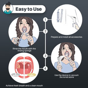 App kiểm soát điện tonsil đá Remover ngay lập tức hút loại bỏ Kit nhà sử dụng máy hút bụi điện tử tonsil đá sạch hơn - Product Image 6