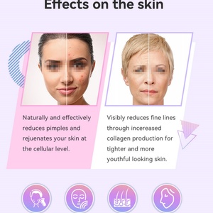 Máquina Facial Portátil de Electroterapia para el Cuidado de la Piel, Varita Galvánica de Alta Frecuencia - Product Image 2