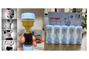 مجموعة فحص الرقبة الضيقة من dar 20 ، أنبوب اختبار طرد مركزي لعلاج الجلد والعظمية - Product Image 2