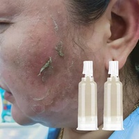 Traitement Anti-Taches Visage Hyperpigmentation, Mélasma et Taches de Rousseur: Crème Éliminatrice de Taches Foncées pour le Soin de la Peau à Base de Spicules d'Éponge
