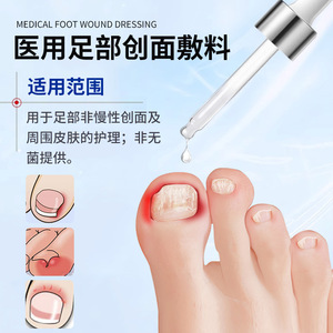 Pansement liquide médical OEM à base de plantes pour les plaies du pied, formule pour le soin des pieds, soulagement des rougeurs - Product Image 2