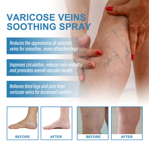 South Moon Spray Herbal <span class=keywords><strong>de</strong></span> 30ml para Alivio <span class=keywords><strong>de</strong></span> Venas Varicosas, Calmante e Hidratante, Mejora y Elimina <span class=keywords><strong>las</strong></span> Arañas Vasculares - Product Image 3