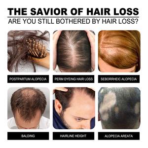 Champú de ajo de etiqueta privada, champú anticaspa para el cabello, champú para el crecimiento anticaída, champú nutritivo para el cabello - Product Image 6