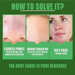 EELHOE face whitening essence niacinamide <span class=keywords><strong>anti</strong></span> ossidazione pori olio restringente controllo della pelle siero rassodante rassodante al tè verde - Product Image 6