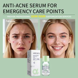 Esencia Antiacné MERCILEN, <span class=keywords><strong>Productos</strong></span> Faciales Antienvejecimiento de Acción Rápida, Blanqueamiento, Control de Grasa, Reparación de la Piel, Suero Antiacné con Ácido Salicílico - Product Image 2