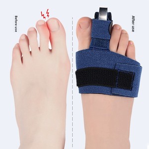 Adjustable Single <strong>Toe</strong> Corrector EVA Gel Splint with Aluminum Plate Protective Gear for <strong>Toe</strong> Bending Bow Finger <strong>Support</strong> - Product Image 3