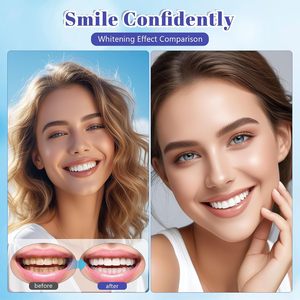 Kit de blanchiment des dents en gel, 8 recharges, seringues de gel blanchissant pour éliminer les taches, portable, adapté aux voyages, pour un sourire éclatant - Product Image 3