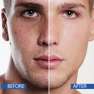 Ensemble de soins de la <span class=keywords><strong>peau</strong></span> de contrôle et d'hydratation de l'huile pour hommes en gros d'usine, contenant des acides aminés, niacinamide, ensemble de soins de la <span class=keywords><strong>peau</strong></span> blanchissant - Product Image 6