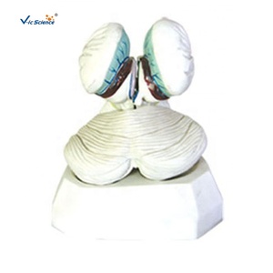 Modello Anatomico dell'Organo del Corpo Umano del Quarto Ventrice con Tessuto Coroidale e Plexo Coroidale per Formazione Medica - Product Image 2