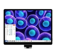 Phenix Microscope Accessories 10.5 Inch HD LCD Touch Screen Wifi Digital Microscope 8MP 4K Camera Really Color Android System