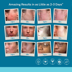 Crème pour le visage à l'acide salicylique, contrôle du sébum, resserre les pores, hydrate, réduit les ridules, pour femmes, tous types de peau - Product Image 3
