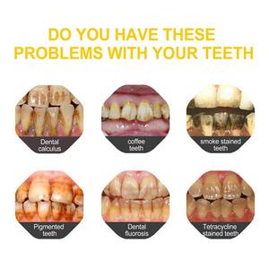 Gel blanchissant pour les dents <span class=keywords><strong>Meixu</strong></span> Discount Non Peroxide Professionnel Fort Blanchiment des dents Hybride Double Désensibilisant Soin blanchissant Non toxique pour usage domestique - Product Image 3