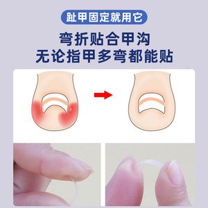 [Xin Zhangmen] Toenail Fixation and Care Patches 10 Patches/Box, Nail Groove Corrector, Orthognathic Patch, <b>Physical</b> Assistance - Product Image 4