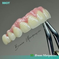BAOT PFM Métal Céramique Dentaire Porcelaine Poudre JC Bond GLAZE TACHE GINGIVA MARGE CERVICAL TRANSPARENT ÉMAIL DENTINE OPAQUE