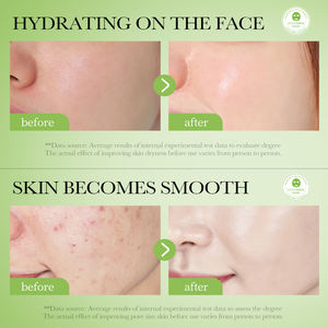 Masques cosmétiques OEM BIOAQUA <span class=keywords><strong>Concombre</strong></span> Vitamine C Boue de la mer Morte Masques nettoyants pour éliminer les points noirs <span class=keywords><strong>Masque</strong></span> à l'<span class=keywords><strong>argile</strong></span> Produits de beauté - Product Image 3