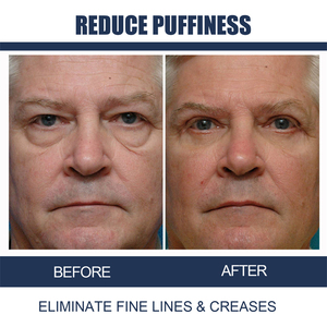 Openeyes Men Awaken Peptide Lifting Eye Gel, crème pour les <span class=keywords><strong>yeux</strong></span> hydratante, éclaircissante, réduisant les <span class=keywords><strong>cernes</strong></span> et les poches sous les <span class=keywords><strong>yeux</strong></span>, pour <span class=keywords><strong>homme</strong></span> - Product Image 3