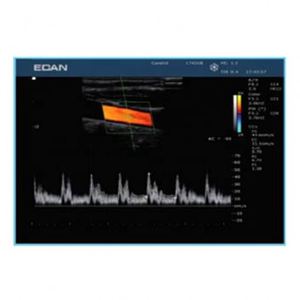 <span class=keywords><strong>Edan</strong></span> U50 Portable Color Doppler <span class=keywords><strong>Ultrasound</strong></span> Pemindai Ultrasonografi Superior - Product Image 5