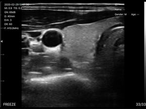 Sonde d'échographie sans fil Wifi <span class=keywords><strong>USG</strong></span>, compatible IOS et Android, sonde transvaginale, sonde d'échographie portable sans fil pour vétérinaires - Product Image 2