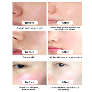 Solution tonifiante anti-acné biologique liquide avec <span class=keywords><strong>acide</strong></span> <span class=keywords><strong>salicylique</strong></span> et extrait de Centella pour le contrôle du sébum et l'hydratation de la peau - Product Image 4