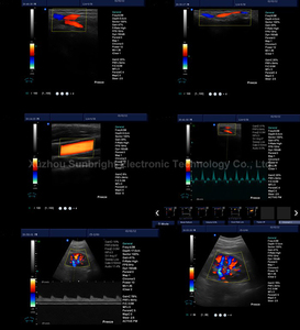 Système d'échographie Doppler couleur numérique complet de type chariot CE JM-908A, idéal pour des diagnostics complets, y compris abdominaux - Product Image 2