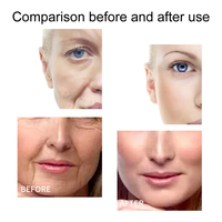 OEM collagène sérum pour le visage acide hydraulique rides élimination peau blanchissant réparateur vitamine c sérum pour le visage sérum anti-âge