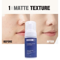 Nettoyant hydratant pour le visage, Logo personnalisé, exfoliants, Bifida, acide aminé, soins de la peau, lavage du visage, traitement de l'acné, Mousse nettoyante en profondeur