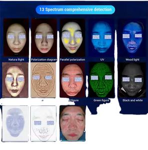 Analyseur de Peau Puremi 3D Diagnostic AI avec Scanner Facial et Caméra HD 4K – <span class=keywords><strong>Meilleur</strong></span> Scanner <span class=keywords><strong>d</strong></span>'Analyse Cutanée 2025 à Vendre - Product Image 5