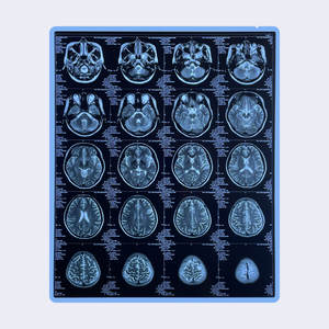 Синяя Тепловая рентгеновская пленка диагностическая медицинская сухая пленка для CT <span class=keywords><strong>DR</strong></span> MRI 8 "X10" 14 "X17" для Fuji AGFA HQ LUCKY Printers - Product Image 5