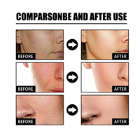 Crème éclaircissante Rejeon, effet identique à Cosmelan, résout efficacement le mélasma, les taches brunes, l'hyperpigmentation