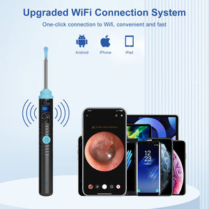 אלחוטי חכם שואב האוזן 1296p אולטרה אוזן מוט מוט מוט מוט אוטוסקופ - Product Image 2